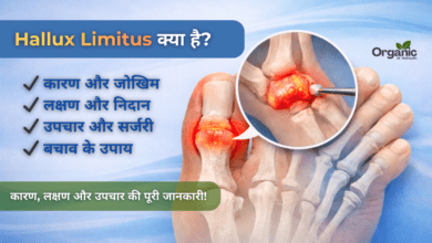 Hallux Limitus Allwellhealthorhanic.com wellhealthorganic.com Best Health tips Health Tips