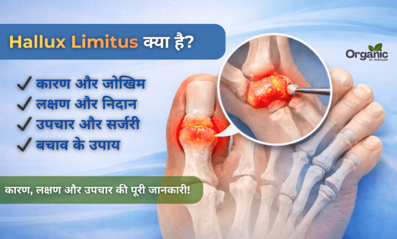 Hallux Limitus Allwellhealthorhanic.com wellhealthorganic.com Best Health tips Health Tips