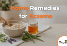 Home Remedies for Eczema Allwellhealthorhanic.com wellhealthorganic.com Best Health tips Health Tips