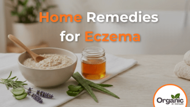 Home Remedies for Eczema Allwellhealthorhanic.com wellhealthorganic.com Best Health tips Health Tips