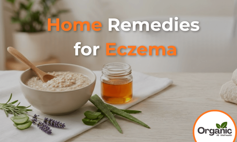 Home Remedies for Eczema Allwellhealthorhanic.com wellhealthorganic.com Best Health tips Health Tips