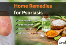 Home Remedies for Psoriasis Allwellhealthorhanic.com wellhealthorganic.com Best Health tips Health Tips