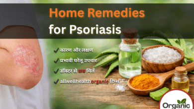 Home Remedies for Psoriasis Allwellhealthorhanic.com wellhealthorganic.com Best Health tips Health Tips