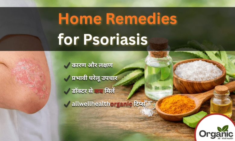 Home Remedies for Psoriasis Allwellhealthorhanic.com wellhealthorganic.com Best Health tips Health Tips