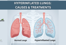 Hyperinflated Lungs Allwellhealthorganic