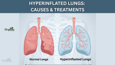 Hyperinflated Lungs Allwellhealthorganic