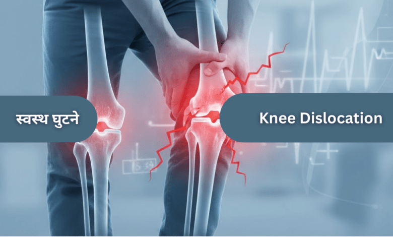 Knee Dislocation Allwellhealthorganic