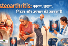 Osteoarthritis Allwellhealthorhanic.com wellhealthorganic.com Best Health tips Health Tips