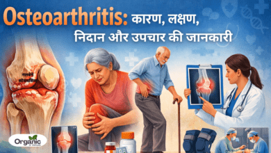 Osteoarthritis Allwellhealthorhanic.com wellhealthorganic.com Best Health tips Health Tips