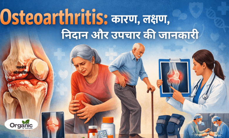 Osteoarthritis Allwellhealthorhanic.com wellhealthorganic.com Best Health tips Health Tips