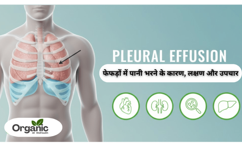 Pleural Effusion Allwellhealthorganic