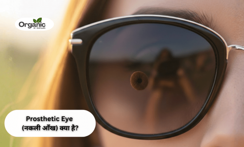 Prosthetic Eye Allwellhealthorhanic.com wellhealthorganic.com Best Health tips Health Tips (1)