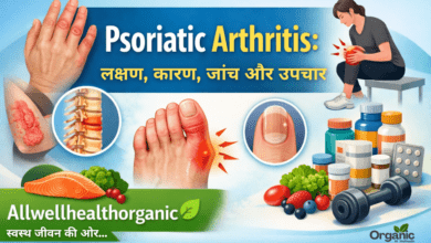 Psoriatic Arthritis Allwellhealthorhanic.com wellhealthorganic.com Best Health tips Health Tips