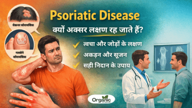Psoriatic Disease.. Allwellhealthorhanic.com wellhealthorganic.com Best Health tips Health Tips