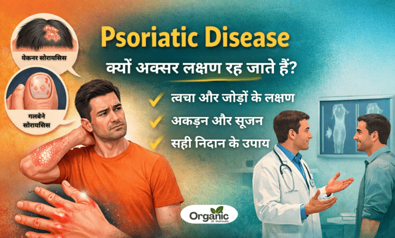 Psoriatic Disease.. Allwellhealthorhanic.com wellhealthorganic.com Best Health tips Health Tips