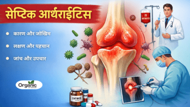 Septic Arthritis Allwellhealthorhanic.com wellhealthorganic.com Best Health tips Health Tips