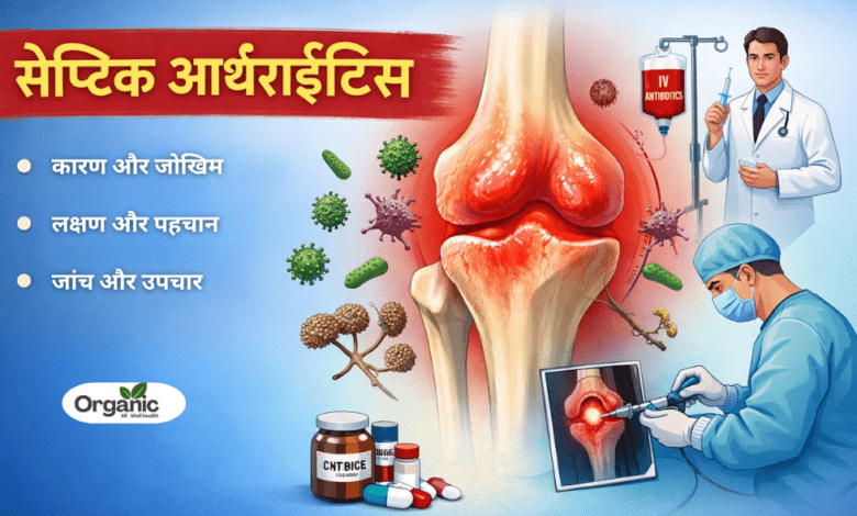 Septic Arthritis Allwellhealthorhanic.com wellhealthorganic.com Best Health tips Health Tips