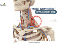 Thoracic Outlet Syndrome Allwellhealthorganic