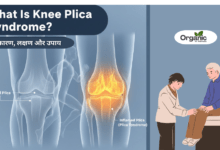 What Is Knee Plica Syndrome Allwellhealthorganic
