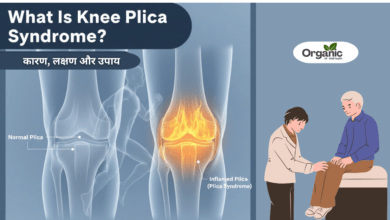 What Is Knee Plica Syndrome Allwellhealthorganic