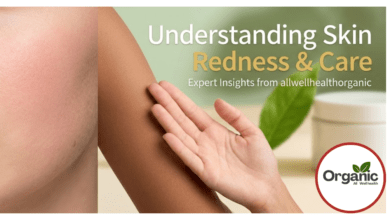 Causes of Redness on Skin Allwellhealthorhanic.com wellhealthorganic.com Best Health tips Health Tips