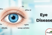 Eye Diseases Allwellhealthorhanic.com wellhealthorganic.com Best Health tips Health Tips