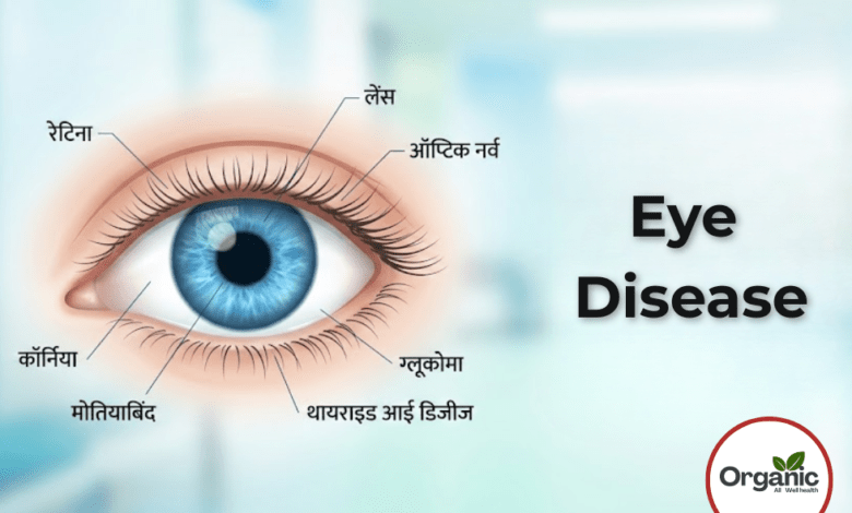 Eye Diseases Allwellhealthorhanic.com wellhealthorganic.com Best Health tips Health Tips