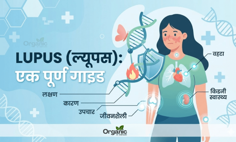 Lupus Allwellhealthorhanic.com wellhealthorganic.com Best Health tips Health Tips