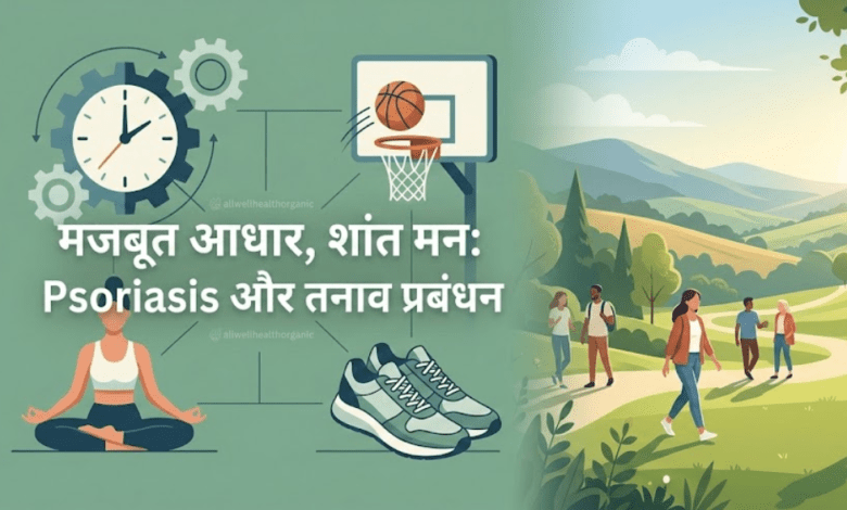 Psoriasis Allwellhealthorhanic.com wellhealthorganic.com Best Health tips Health Tips