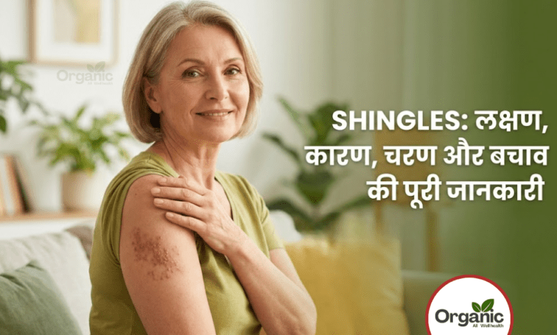 Shingles Allwellhealthorhanic.com wellhealthorganic.com Best Health tips Health Tips