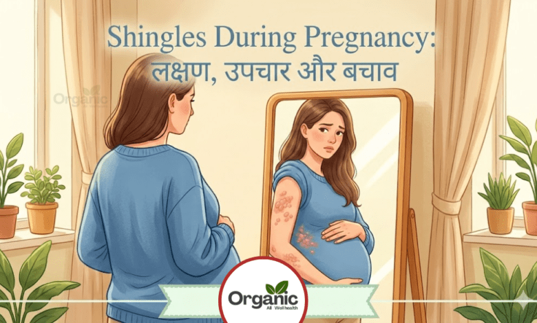 Shingles During Pregnancy