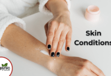Skin Conditions Allwellhealthorhanic.com wellhealthorganic.com Best Health tips Health Tips
