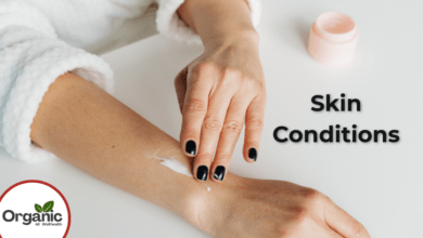 Skin Conditions Allwellhealthorhanic.com wellhealthorganic.com Best Health tips Health Tips