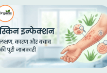 Skin Infection Allwellhealthorhanic.com wellhealthorganic.com Best Health tips Health Tips
