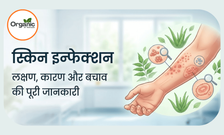 Skin Infection Allwellhealthorhanic.com wellhealthorganic.com Best Health tips Health Tips