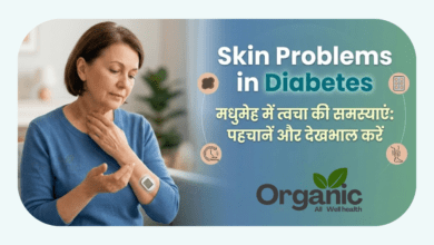 Skin Problems in Diabetes Allwellhealthorhanic.com wellhealthorganic.com Best Health tips Health Tips