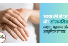 Skin Symptoms of Psoriasis Allwellhealthorhanic.com wellhealthorganic.com Best Health tips Health Tips