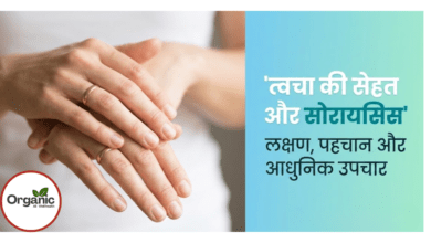 Skin Symptoms of Psoriasis Allwellhealthorhanic.com wellhealthorganic.com Best Health tips Health Tips