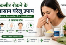 Home Remedies for Nosebleed - नकसीर रोकने के आसान घरेलू उपाय