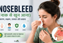 Nosebleed | नाक से खून आना