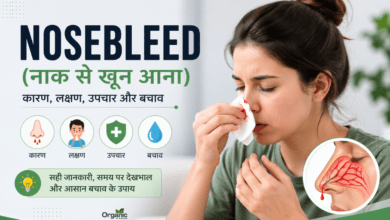 Nosebleed | नाक से खून आना
