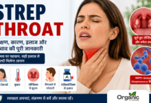 Strep Throat क्या है
