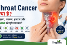 Throat Cancer क्या है