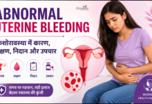Abnormal Uterine Bleeding (AUB) in adolescents showing menstrual pain, uterus illustration, and key health information.