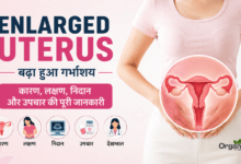 Enlarged Uterus (बढ़ा हुआ गर्भाशय) का मेडिकल चित्र और इसके प्रमुख कारण, लक्षण व उपचार।