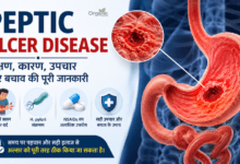 Peptic Ulcer Disease infographic showing stomach ulcer, H. pylori infection, NSAID use, symptoms, causes, treatment, and prevention of peptic ulcers.