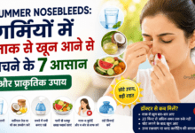 Summer Nosebleeds: गर्मियों में नाक से खून आने से बचने के 7 आसान प्राकृतिक उपाय