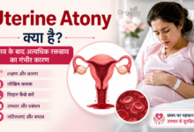 Uterine Atony के कारण प्रसव के बाद अत्यधिक रक्तस्राव दर्शाता मेडिकल इन्फोग्राफिक।