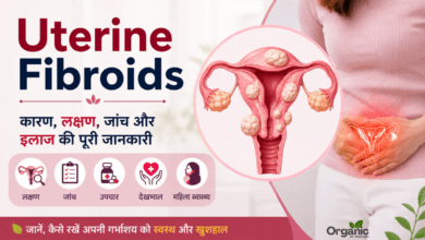 Uterine Fibroids in women – causes, symptoms, diagnosis, and treatment illustration.