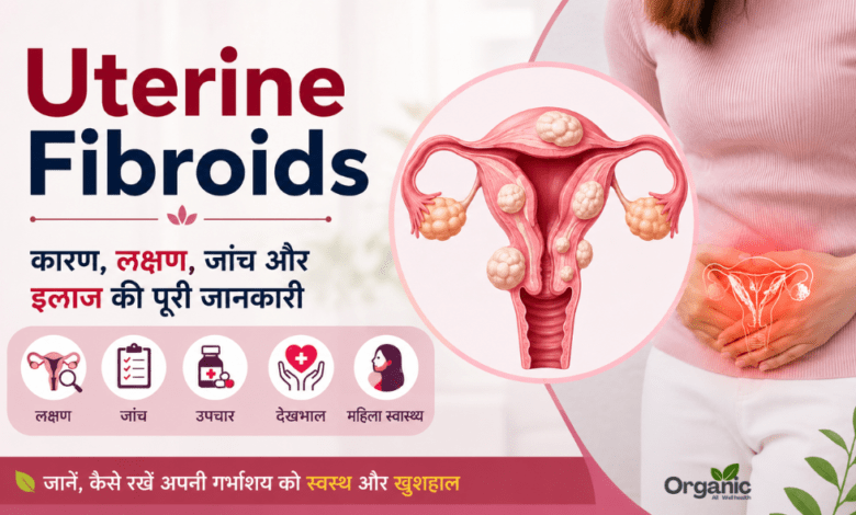 Uterine Fibroids in women – causes, symptoms, diagnosis, and treatment illustration.